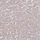 Immunohistochemical staining of human liver shows weak cytoplasmic positivity in hepatocytes.