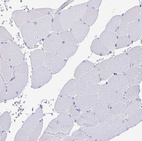 Immunohistochemical staining of human skeletal muscle shows no positivity in myocytes as expected.