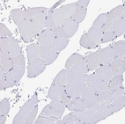 Immunohistochemical staining of human skeletal muscle shows no positivity in myocytes as expected.