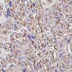Immunohistochemical staining of human placenta shows strong positivity in secretion in chorionic villi.
