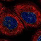 Immunofluorescent staining of human cell line A-431 shows localization to nuclear membrane.