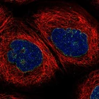 Immunofluorescent staining of human cell line A-431 shows localization to nuclear membrane.
