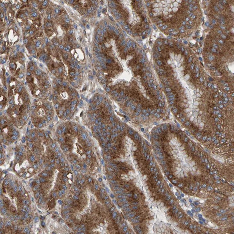 Anti-MKLN1 Antibody