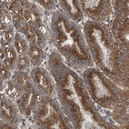Anti-MKLN1 Antibody