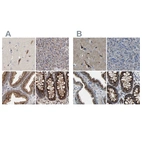 Immunohistochemical staining of human cerebral cortex, pancreas, prostate and rectum using Anti-CANT1 antibody HPA022818 (A) shows similar protein distribution across tissues to independent antibody HPA019627 (B).