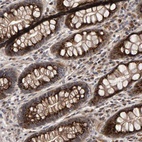 Immunohistochemical staining of human rectum shows high expression.