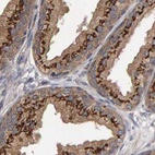 Immunohistochemical staining of human prostate using Anti-CANT1 antibody HPA022818.