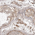 Immunohistochemical staining of human testis shows moderate to strong cytoplasmic positivity in Leydig cells.