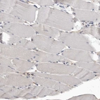 Immunohistochemical staining of human skeletal muscle shows moderate to strong cytoplasmic positivity in myocytes.