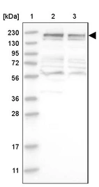 Lane 1: Marker [kDa] 230, 130, 95, 72, 56, 36, 28, 17, 11_br/_Lane 2: Human cell line RT-4_br/_Lane 3: Human cell line U-251MG sp
