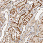 Anti-ITPA Antibody