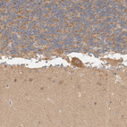 Immunohistochemical staining of human cerebellum shows moderate granular cytoplasmic positivity in Purkinje cells.