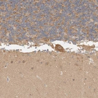 Immunohistochemical staining of human cerebellum shows moderate granular cytoplasmic positivity in Purkinje cells.