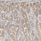Immunohistochemical staining of human duodenum shows weak granular cytoplasmic positivity in glandular cells.