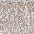 Anti-ITPA Antibody