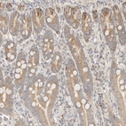 Immunohistochemical staining of human duodenum shows weak granular cytoplasmic positivity in glandular cells.