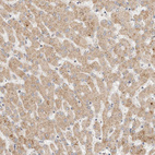 Immunohistochemical staining of human liver shows weak granular cytoplasmic positivity in hepatocytes.