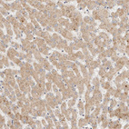 Anti-ITPA Antibody