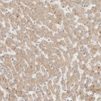 Immunohistochemical staining of human liver shows weak granular cytoplasmic positivity in hepatocytes.