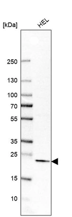 Western blot analysis in human cell line HEL.