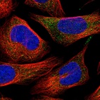 Immunofluorescent staining of human cell line U-2 OS shows localization to cytosol.