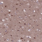 Anti-EMC2 Antibody