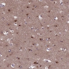 Anti-EMC2 Antibody