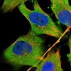 Immunofluorescent staining of human cell line U-251 MG shows localization to cytosol.