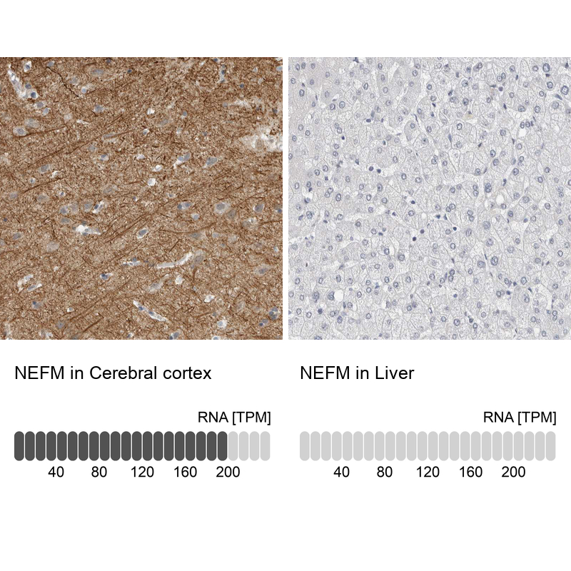 Anti-NEFM Antibody