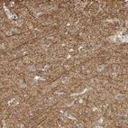 Immunohistochemical staining of human cerebral cortex shows strong cytoplasmic positivity in neurons.