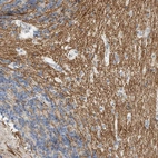 Immunohistochemical staining of human cerebellum shows strong cytoplasmic positivity in white matter.
