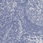 Anti-NEFM Antibody