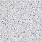 Immunohistochemical staining of human liver shows no positivity in hepatocytes as expected.