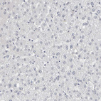 Anti-NEFM Antibody