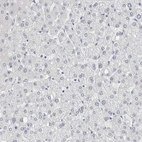 Immunohistochemical staining of human liver shows no positivity in hepatocytes as expected.