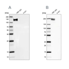 Western blot analysis using Anti-NEFM antibody HPA022845 (A) shows similar pattern to independent antibody HPA023138 (B).