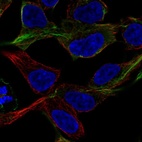 Immunofluorescent staining of human cell line HEK 293 shows localization to intermediate filaments.