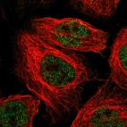 Immunofluorescent staining of human cell line A-431 shows localization to nucleoplasm.