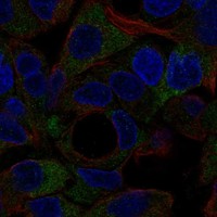 Anti-NOTUM Antibody