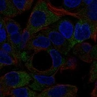 Anti-NOTUM Antibody