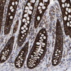 Anti-MRPL12 Antibody