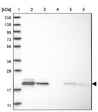 Lane 1: Marker [kDa] 230, 130, 95, 72, 56, 36, 28, 17, 11_br/_Lane 2: Human cell line RT-4_br/_Lane 3: Human cell line U-251MG sp_br/_Lane 4: Human plasma (IgG/HSA depleted)_br/_Lane 5: Human liver tissue_br/_Lane 6: Human tonsil tissue