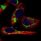 Anti-MRPL12 Antibody