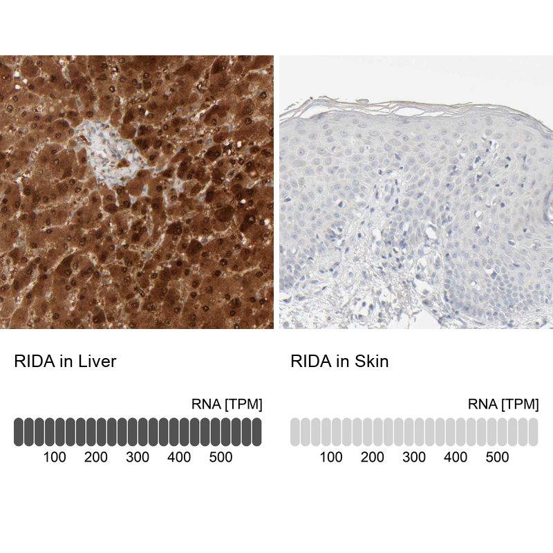 Anti-RIDA Antibody