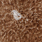 Immunohistochemical staining of human liver shows strong cytoplasmic and nuclear positivity in hepatocytes.