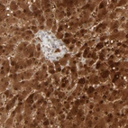 Immunohistochemical staining of human liver shows strong cytoplasmic and nuclear positivity in hepatocytes.