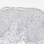 Immunohistochemical staining of human skin shows no positivity in squamous epithelial cells as expected.