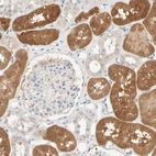 Immunohistochemical staining of human kidney shows moderate cytoplasmic positivity in cells in tubules.