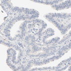 Immunohistochemical staining of human Fallopian tube shows no positivity in glandular cells as expected.