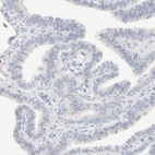 Immunohistochemical staining of human Fallopian tube shows no positivity in glandular cells as expected.